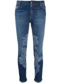 lace-appliqué skinny jeans