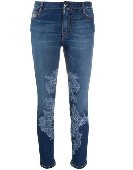 lace-appliqué skinny jeans