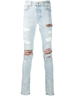 distressed skinny jeans